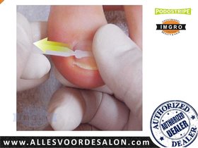 フットケア starterBOX Podostripe 3TO Treatment with PODOSTRIPE – 3TO – Ihr Spezialist für