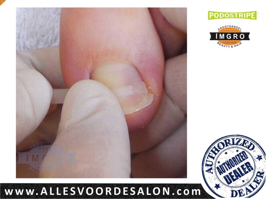 Startset Podostripe, compleet - IMGRO Beauty